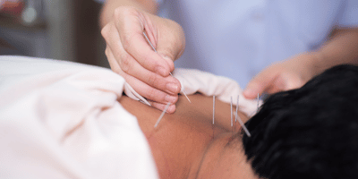 Acupuncture Course